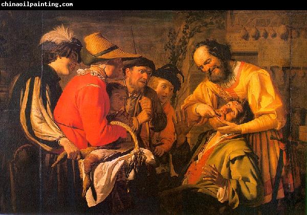 Gerrit van Honthorst The Tooth Puller