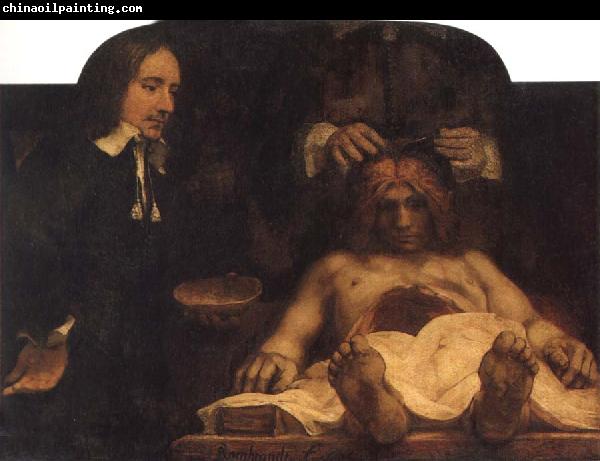 REMBRANDT Harmenszoon van Rijn The Anatomy Lesson of Dr.Joan Deyman