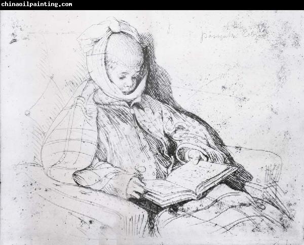 Carl Larsson Mumps Etching