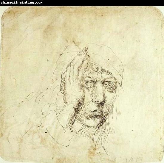 Albrecht Durer Self-Portrait with a Bandage