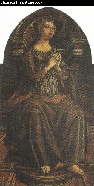 Sandro Botticelli Piero del Pollaiolo Hope (mk36)